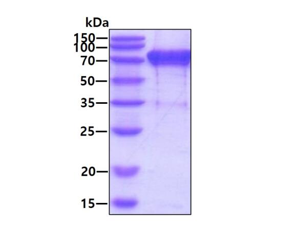 3 μg by SDS-PAGE under reducing condition and visualized by coomassie blue stain.